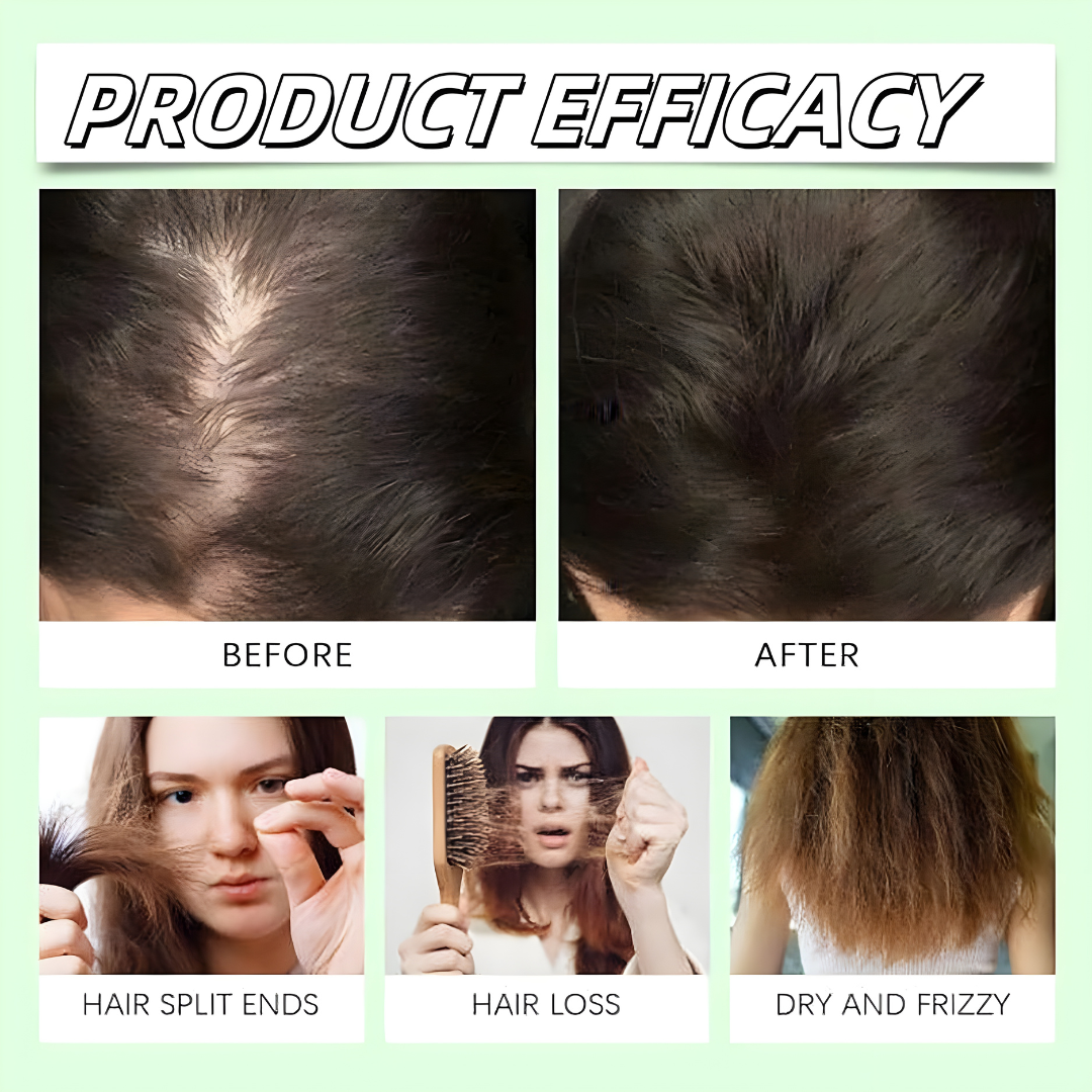 Anti Hair Loss Shampoo