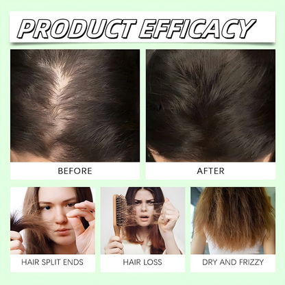 Anti Hair Loss Shampoo